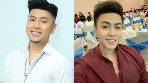 Akira Phan trước và sau khi phẫu thuật thẩm mỹ Akira Phan trước và sau khi phẫu thuật thẩm mỹ