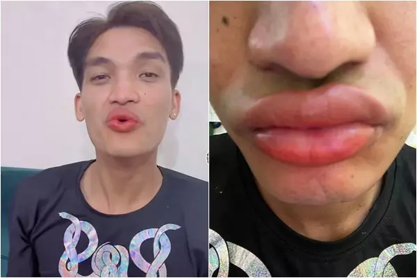 Mạc Văn Khoa cùng bờ môi tều mới làm xong Mạc Văn Khoa cùng bờ môi tều mới làm xong