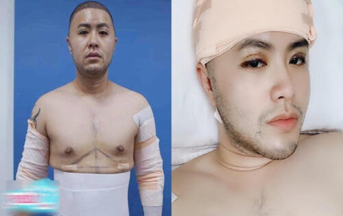 Nam ca sĩ trong cuộc phẫu thuật tốn hơn 300 triệu đồng Nam ca sĩ trong cuộc phẫu thuật tốn hơn 300 triệu đồng