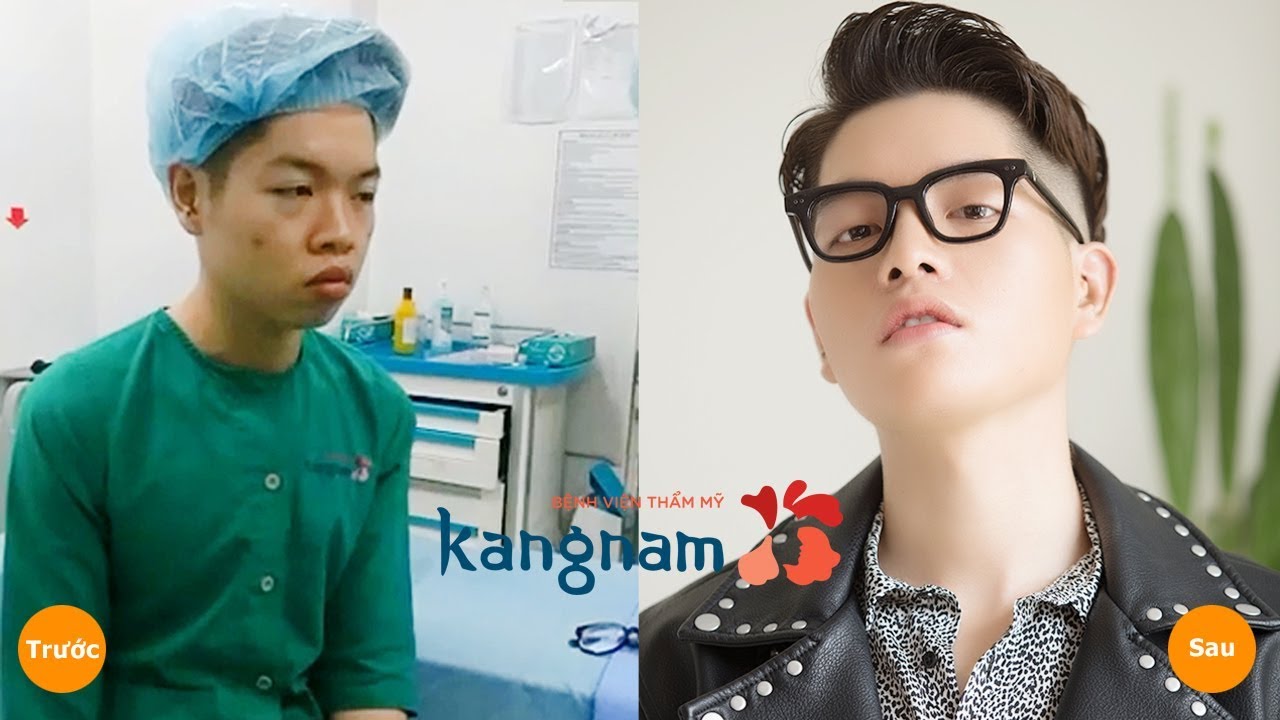 Đức Phúc trước và sau khi phẫu thuật thẩm mĩ Đức Phúc trước và sau khi phẫu thuật thẩm mĩ