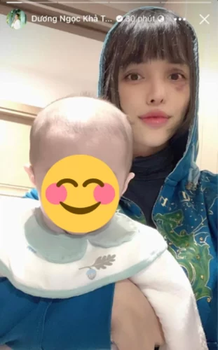 Gương mặt bầm tím của Siêu mẫu khi bên cạnh cậu con trai cưng Gương mặt bầm tím của Siêu mẫu khi bên cạnh cậu con trai cưng