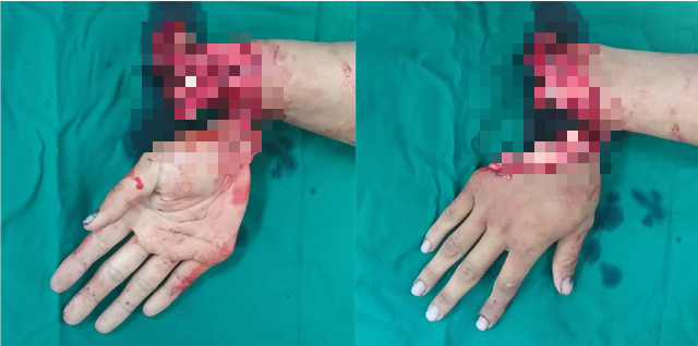 Đây quả thực là một tai nạn kinh khủng Đây quả thực là một tai nạn kinh khủng