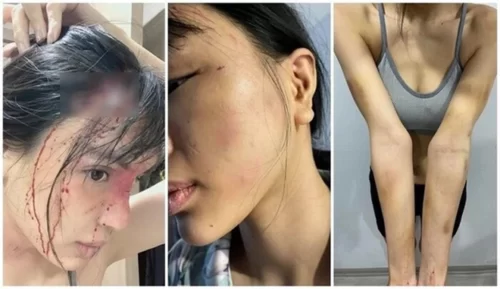 Siêu mẫu Khả Trang bị bạo hành đến " thân tàn ma dại" Siêu mẫu Khả Trang bị bạo hành đến " thân tàn ma dại"