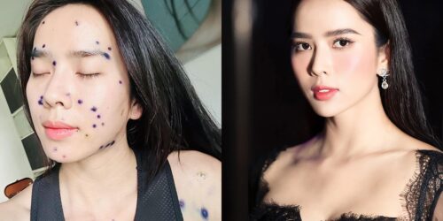 Bella Mai đi dự sự kiện sau nửa tháng mắc bệnh thủy đậu
