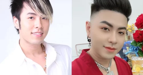 Akira Phan "trổ bóng" sau khi phẫu thuật thẩm mỹ
