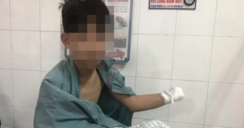 2 nam sinh thương vong sau vụ nổ kinh hoàng